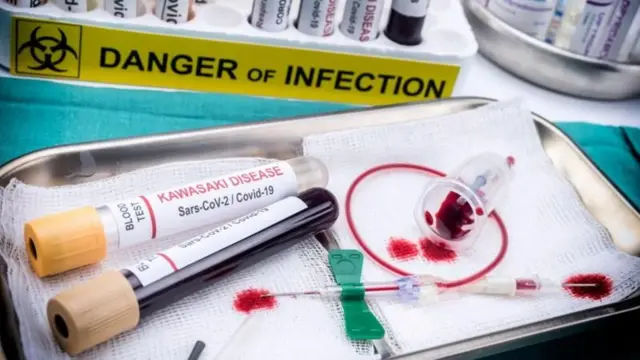 મુનવ્વર ફારૂકી, ગુજરાત, જૂનાગઢ, બીબીસી ગુજરાતી, કૉમેડિયન, કાવાસાકી બીમારી, હેલ્થ, આરોગ્ય, રોગ
