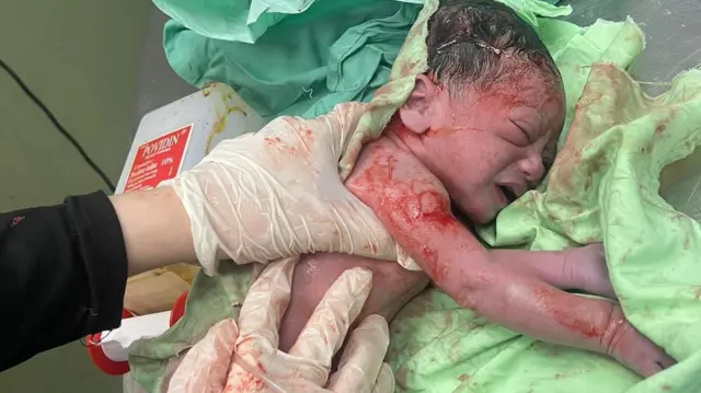 Sara membantu persalinan