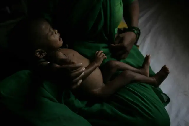 तुटपुंजे उत्पन्न आणि महागाई यामुळे या ठिकाणी संतुलित आहार मिळणे अवघड असते.