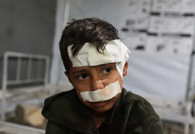 طفل فلسطيني جريح يتلقى العلاج في مستشفى الأهلي العربي بمدينة غزة، بعد غارة إسرائيلية على منزل، وفقًا لمسعفين، في 28 أكتوبر/تشرين الأول 2025.