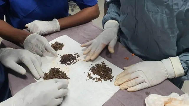 Hakiimota cirracha hadhootuu dubartii keessaa baasan