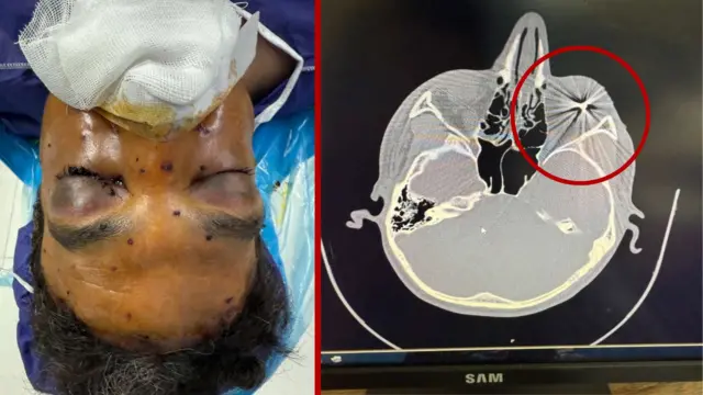 تصویر سی‌تی‌ اسکن و یکی از آسیب دیدگاه چشمی که به دست بی‌بی‌سی فارسی رسیده 
