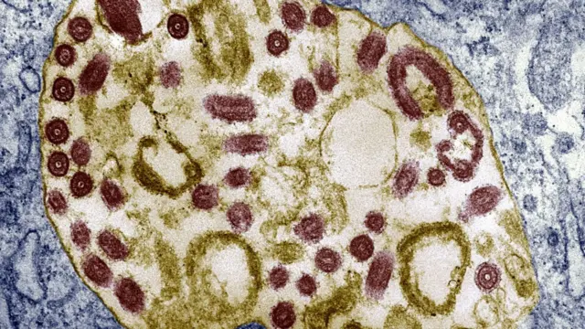 ቫይረስ ማርበርግ