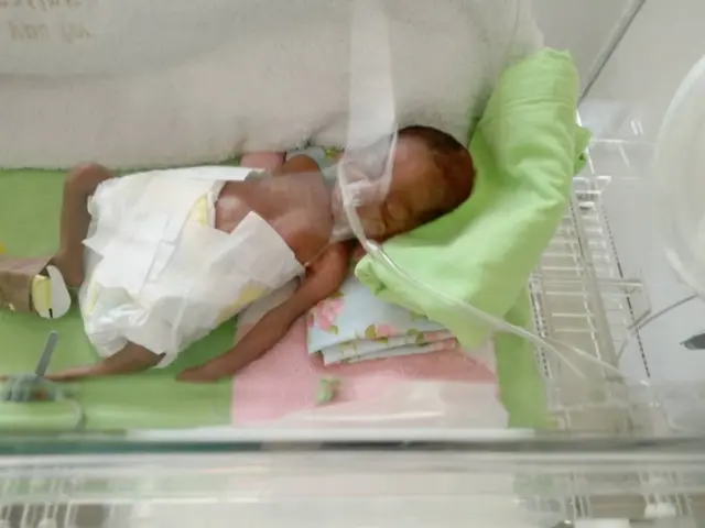 Nwata ahụ mgbe a mụrụ ya