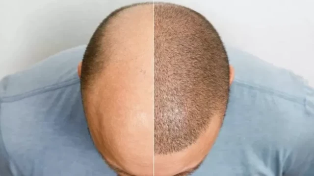 وېښتان