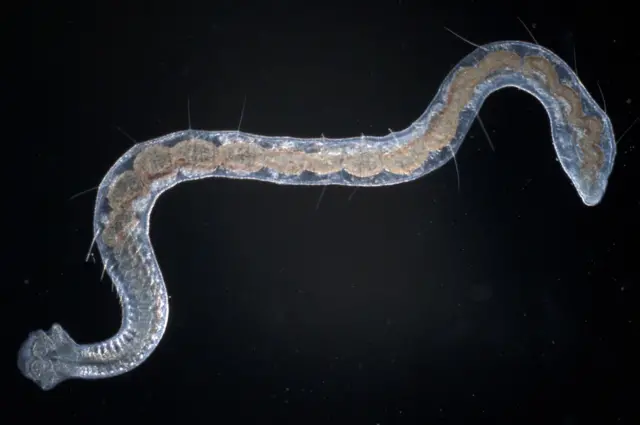 நாடாப்புழு