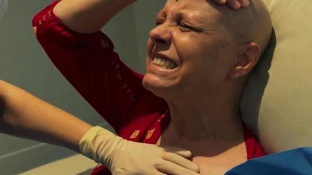 Claudia deitada na maca, sem cabelo, fazendo caracomo acertar na lotomaníador