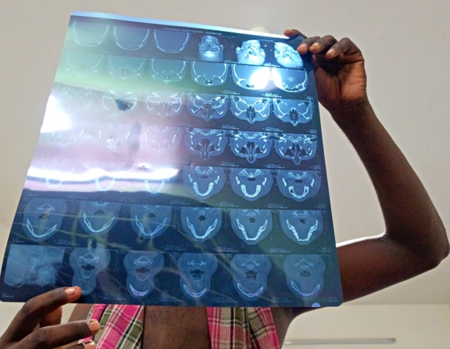 நெல்லை பட்டியலின இளைஞர்கள் தாக்கப்பட்ட விவகாரம்