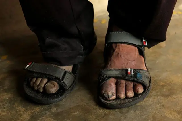 ඉසුරු පවසන පරිදි, සමාජයේ සැබෑ ආකල්පමය වෙනස ඇති වන්නේ, රජය විසින් ගනු ලබන ප්‍රතිපත්තිමය තීරණවලින් මිස "වචන වෙනස් කරන්න ගහන ගැසට්වලින්," නොවන බව ය.