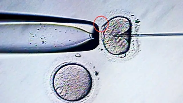 নিষিক্ত ভ্রূণ গর্ভে স্থাপন