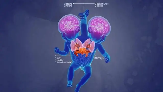 تشترك مريم وندى في بعض الأعضاء الرئيسية كما أن لهما أيضًا أعضاء منفصلة خاصة بهما