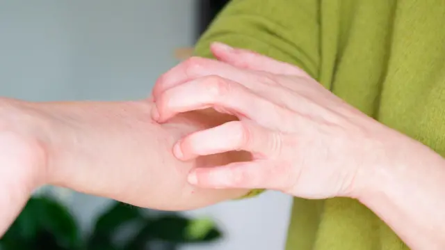 तनाव त्वचा की कोशिकाओं को हिस्टामिन जैसे रसायन छोड़ने के लिए उकसाता है, जिससे खुजली होती है