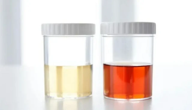 మూత్రం రంగులు