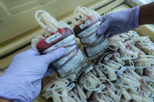 Petugas PMI Sultra menujukkan kantong darah pada kegiatan donor darah di Balai Kota Kendari, Sulawesi Tenggara, Senin (9/12/2024). Kegiatan tersebut diikuti Aparatur Sipil Negara (ASN) tingkat Kota Kendari dalam rangka memperingati Hari Anti Korupsi Sedunia (HAKORDIA) tahun 2024.