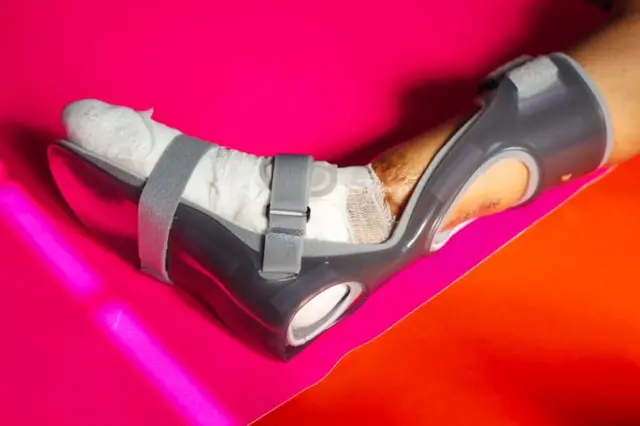 ਫਿਜ਼ੀਓਥੈਰੇਪੀ 