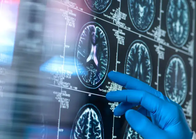 Un médico ante unas radiografías del cerebro