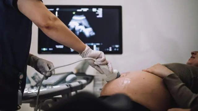 కవల పిల్లలు, ఇద్దరు తండ్రులు, డీఎన్ఏ పరీక్ష