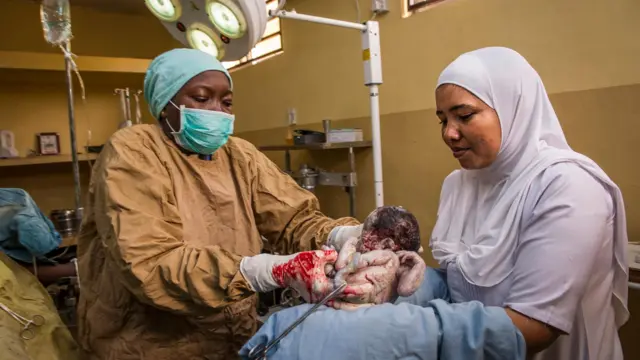 Trained doctor and midwife during one C-Section for Gusau, Nigeria.