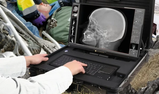 Cette maquette montre comment un appareil à rayons X portable pourrait prendre des photos sur les lieux d'un accident.