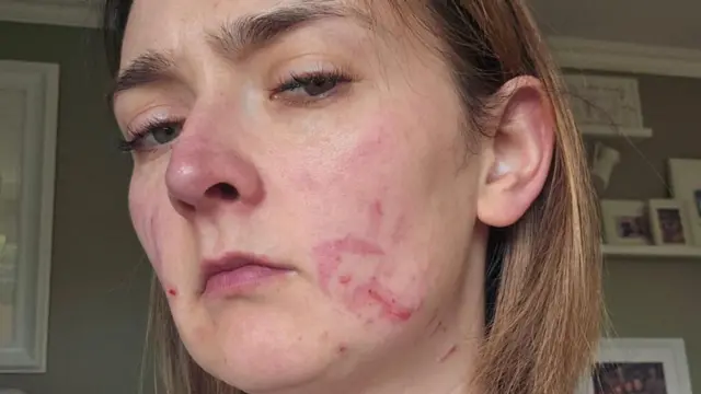 क्लेअर मिलर यांचा मुलगा डॅनी याला ऑटिझम आहे आणि तो शिकण्यास अक्षम आहे, त्यामुळे त्याच्याकडून कधीतरी अनावधानानं हिंसक कृत्यं होतात
