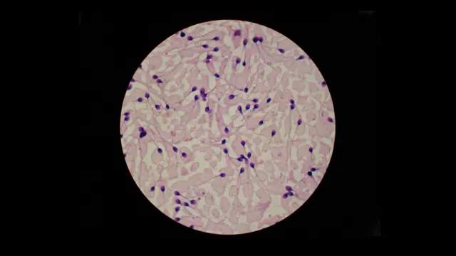 ሓደ ማእከላይ ወዲ ተባዕታይ ኣብ ሓደ ዕልቋቕ ኣስታት 100 ሚልዮን ዋህዮታት ዘርኢ የፍስስ