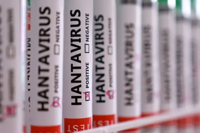Tabung reaksi berlabel 'Hantavirus positif'.