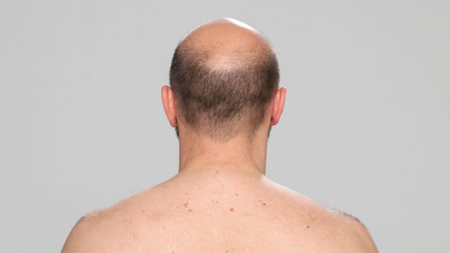 Homem branco calvo e sem camisa, visto de costas