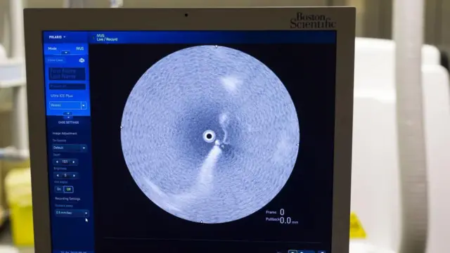 ਸੰਕੇਤਕ ਤਸਵੀਰ