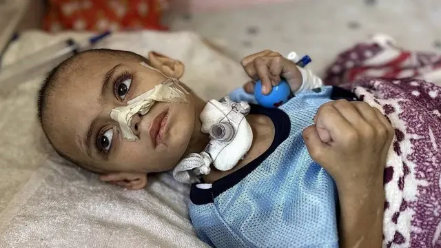 Omar al-Hams, un niño palestino de 3 años que perdió a toda su familia en los ataques aéreos israelíes en el norte de Gaza, recibe tratamiento médico en el Hospital Nasser en Khan Yunis, Gaza, el 26 de junio de 2025.