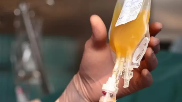 রক্তের প্লাজমা সংগ্রহ বেশ জটিল পদ্ধতি।