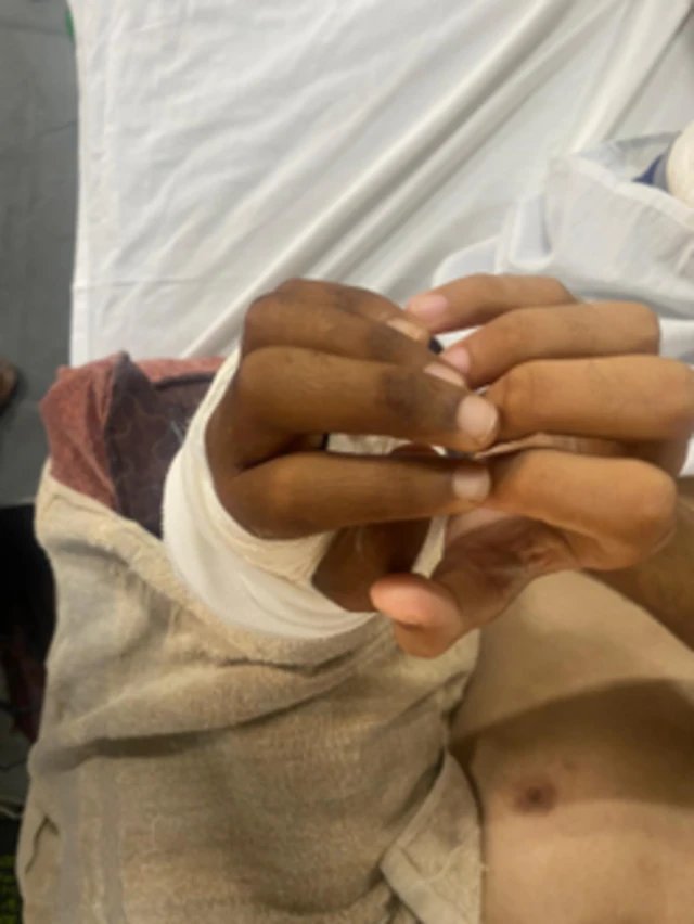 جانب من إصابة الطالب محمود الجزار