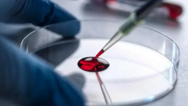 ప్రతీకాత్మక చిత్రం 