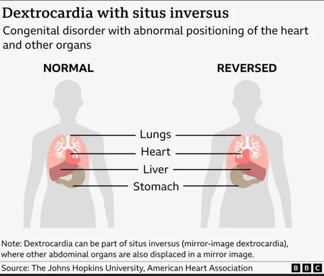 ਦਿਲ ਦੀ ਸਥਿਤੀ ਦੀ ਤੁਲਨਾ