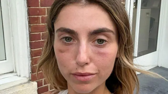 Charlotte Bickley ma na sobie biały top. Ma długie, jasnobrązowe włosy i widoczne cienie tuż nad kośćmi policzkowymi, pod oczami.