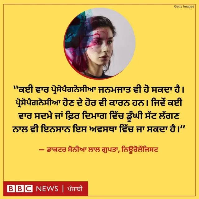 ਪ੍ਰੋਸੋਪੈਗਨੋਸੀਆ