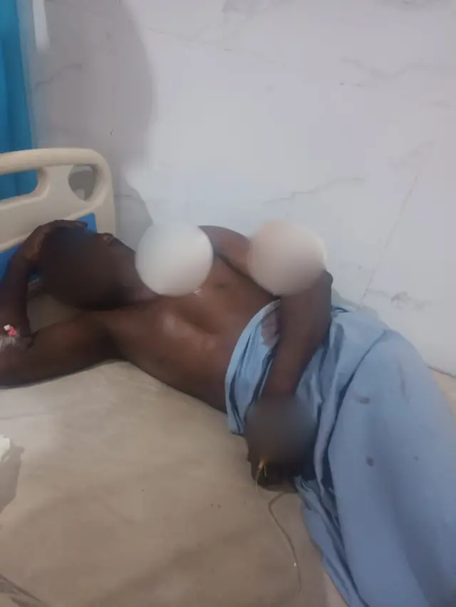 otu onye agbatara egbe na-anata ọgwụgwọ