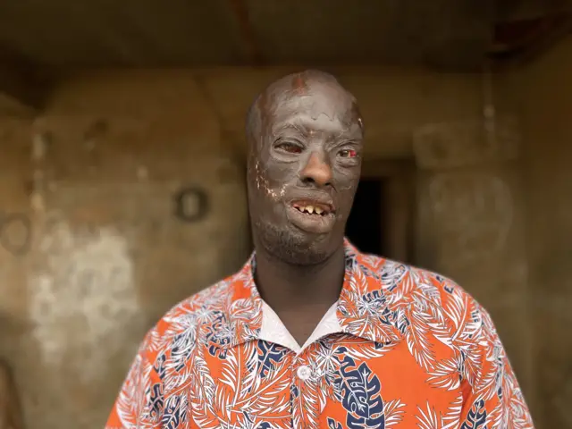 Abbey say im don forgive im cousin