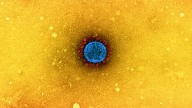 ਸੰਕੇਤਕ ਤਸਵੀਰ