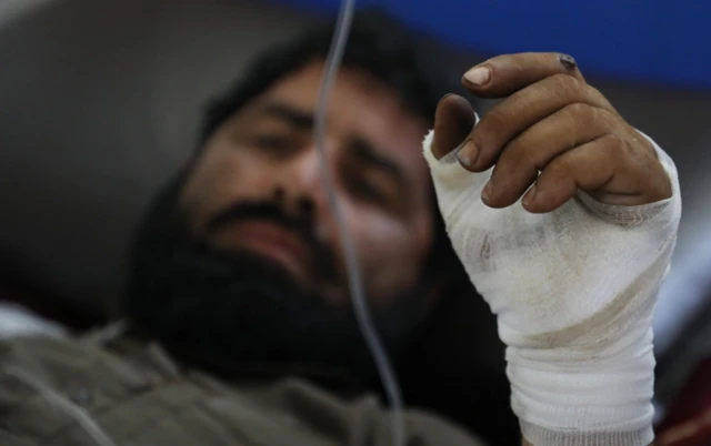 Korban gempa bumi yang terluka menerima perawatan di sebuah rumah sakit di Jalalabad, Afghanistan, 1 September 2025