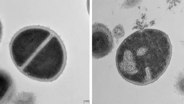 Duas fotos lado a lado de bactérias sob um microscópio: uma saudável e a outra com uma ruptura, vazando seu conteúdo