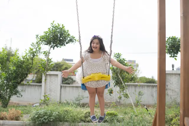 डाउन सिंड्रोम