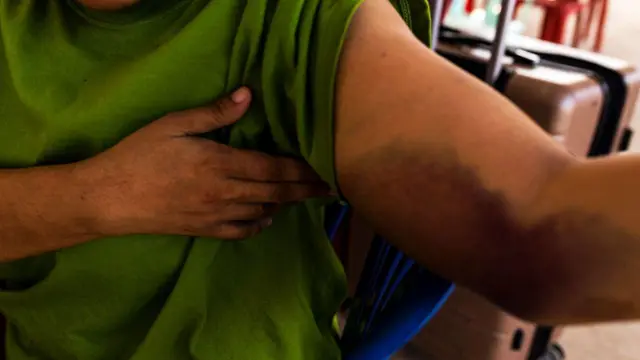 Korban, online scam, luka