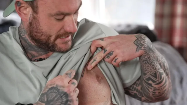 تام پاول پیراهنش را بالا زده و در حال نشان دادن جای جراحی بافت اضافی پستانش است