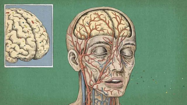मायक्रोप्लास्टिक्सचे कण मेंदूकडे रक्त नेणाऱ्या महत्वाच्या रक्तवाहिन्यांमध्ये देखील (कॅरोटिड आर्टरी) आढळले आहेत.