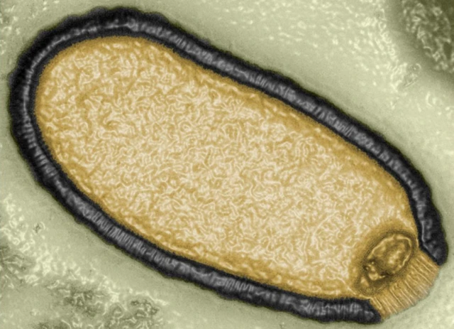 ภาพขยายไวรัสโบราณ Pithovirus sibericum ซึ่งพบในชั้นดินเยือกแข็งคงตัวอายุ 30,000 ปี เมื่อปี 2014