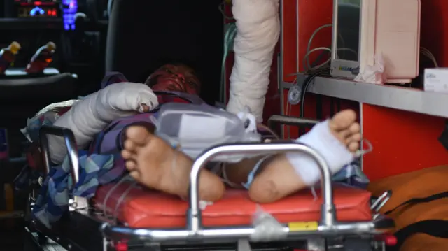 Salah satu korban luka pada peristiwa kecelakaan kerja di lokasi pabrik PT Indonesia Tsingshan Stainless Steel (ITSS) pada kawasan IMIP dipindahkan ke ruangan isolasi di RSUD Morowali di Kabupaten Morowali, Sulawesi Tengah, Selasa (26/12/2023).