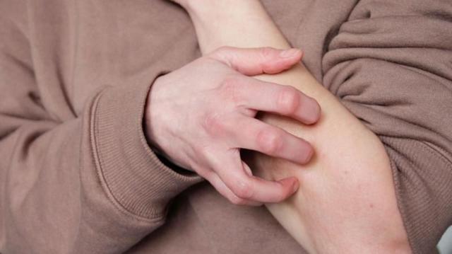 அரிப்பு நோய்