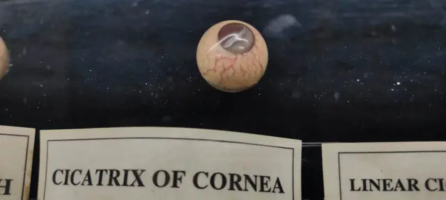 எழும்பூர் கண் மருத்துவமனை - 200 ஆண்டுகால மருத்துவ வரலாறு