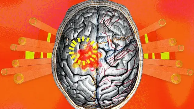 دماغ پر گرمی کے اثرات