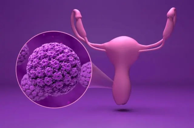 వ్యాక్సీన్, వైద్యం, క్యాన్సర్, మహిళలు